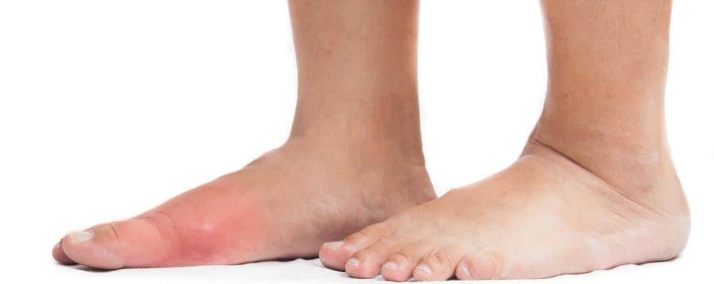foot bump pain